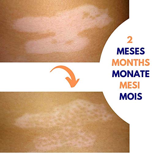 MELADUL Gel Regulador de la Pigmentación para Manchas y Trastornos de la Piel | 50ml | Crema con Dismutin PF® para Manchas en Cara y Cuerpo | Mejora la Regeneración Celular y Alteraciones Cutáneas