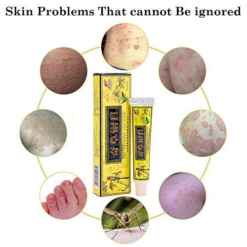 MMENG Chines Medicine Cream Crema Corporal para el Eczema, Crema contra la picazón Uso Externo Solo Crema de Hierbas Chinas Naturales (10 Piezas)