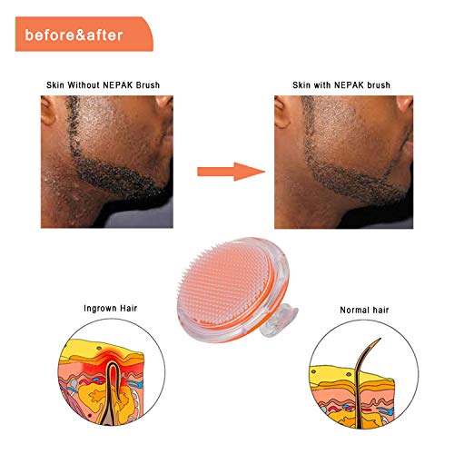 NEPAK Cepillo Exfoliante Corporal Exfoliating Brush-Bikini Line Exfoliator-Body Brush para Piernas y Axilas el Cabello Tratamiento Irritación del Afeitado