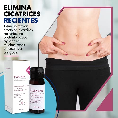 Pack Cicatrices - Parche Reductor de Cicatrices con Ácido Hialurónico + Rosa Mosqueta 100% Natural - Ideal cicatrices y queloides: cesárea, cirugías estéticas, quemaduras
