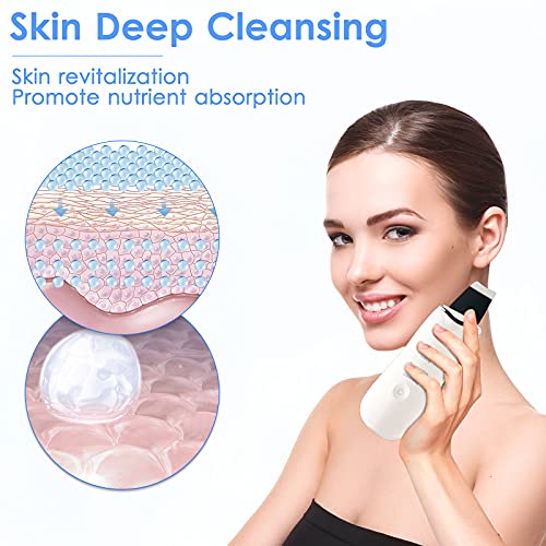 Pala Ultrasónica, Limpiador Ultrasónico de la Piel Facial, Limpiador de Poros, Limpiador Ultrasónico de Iones para Limpieza de Puntos Negros, Horniny, 3 Modos, Carga USB