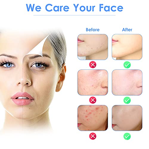 Pala Ultrasónica, Limpiador Ultrasónico de la Piel Facial, Limpiador de Poros, Limpiador Ultrasónico de Iones para Limpieza de Puntos Negros, Horniny, 3 Modos, Carga USB