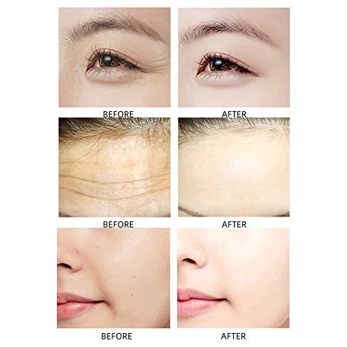Parches Faciales,Parche antiarrugas,Antiarrugas,Parches Antiarrugas,Facial Patches,Parches Faciales Antiarrugas,Antiarrugas Alrededor de Ojos,Facial Patch