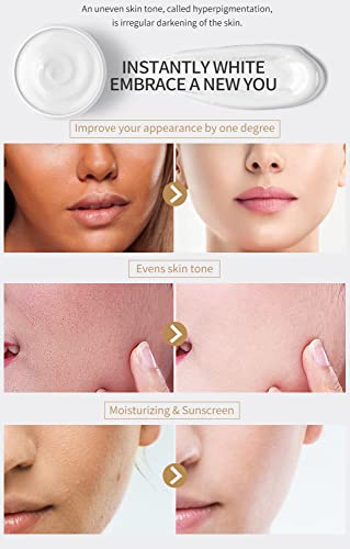 Piel Blanqueo Iluminador Crema por Oscuro Lugares en Cara Años Lugar Sol Lugar Punto Y Melasma Agente de Mudanzas Eficaz Iluminador Nutritivo Efecto Amable Y a Salvo / 30g / White