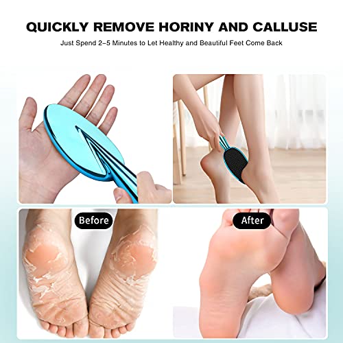 Puikos 2 en 1 Nano cristal Quitacallos con mango ergonómico, lima húmeda y seca para pies y manos, resistente al agua, elimina callos de forma rápida y segura para el cuidado de los pies en casa