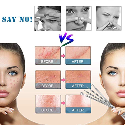 Quita puntos negros de acero inoxidable oro rosa - kit profesional para tratamiento facial - Limpiador de Acne, Poros, Granos, Espinillas Unisex (Juego De 4) (Silver)
