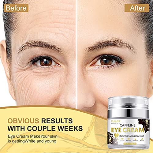 rema para ojos para debajo de los ojos: crema antienvejecimiento, ojeras, hinchazón, crema eficaz para debajo de los ojos para arrugas con retinol, ácido hialurónico, vitamina E