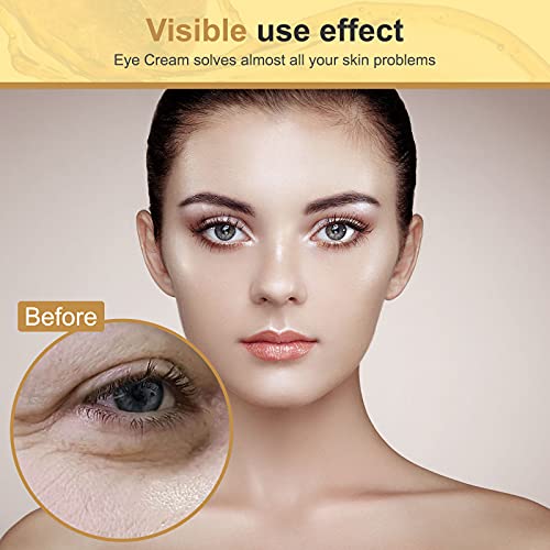 rema para ojos para debajo de los ojos: crema antienvejecimiento, ojeras, hinchazón, crema eficaz para debajo de los ojos para arrugas con retinol, ácido hialurónico, vitamina E