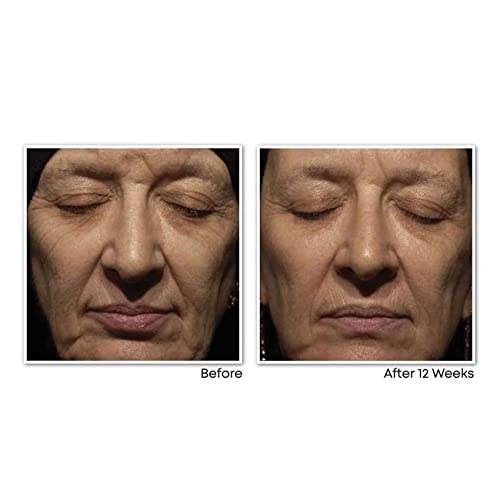 RoC - Retinol Correxion Wrinkle Corrext Crema de Noche - Antiarrugas y Antiedad - Con Retinol y Complejo Mineral Exclusivo - 30 ml