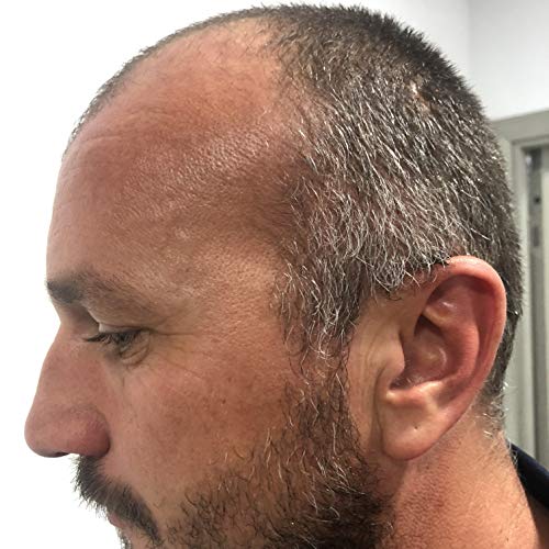Sereni Capelli Hair Elixir / Da a las canas su color natural / Detiene la caída del cabello / Combate la dermatitis y la caspa