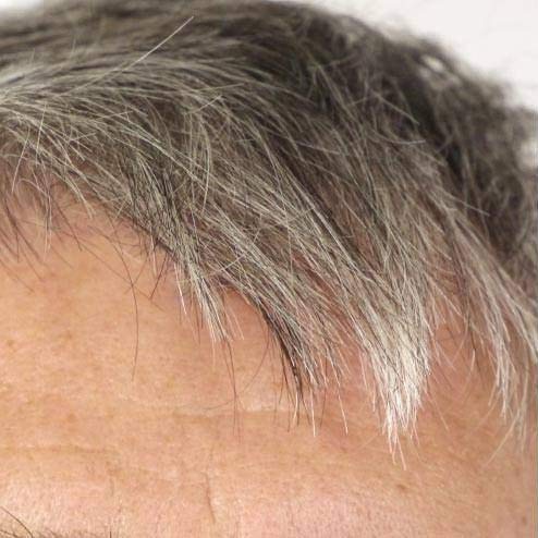 Sereni Capelli Hair Elixir / Da a las canas su color natural / Detiene la caída del cabello / Combate la dermatitis y la caspa