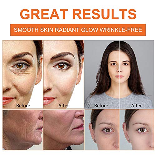 Serum Vitamina C con Suero de ácido Hialurónico, Suero Facial Antiarrugas y Antiarrugas Natural, Potenciar el Colágeno de la Piel
