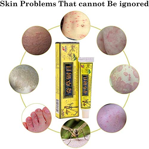 Shirley 3/5/10 Uds.Crema Facial, Crema De Hierbas Chinas Naturales, Crema Corporal, Crema Anti-PicazóN Solo para Uso Externo, Dermatitis E InflamacióN (5PCS)