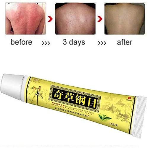 Shirley 3/5/10 Uds.Crema Facial, Crema De Hierbas Chinas Naturales, Crema Corporal, Crema Anti-PicazóN Solo para Uso Externo, Dermatitis E InflamacióN (5PCS)