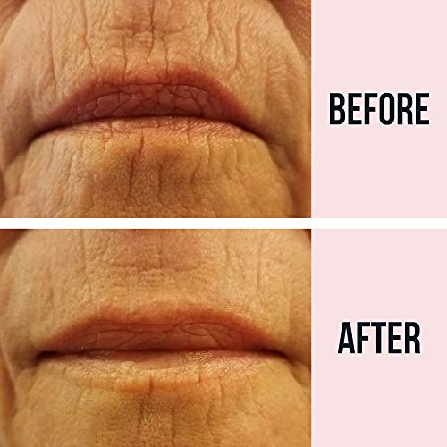 SiO Beauty Super LipLift | Parches antiarrugas para sonrisas y labios 2 semanas de suministro | Parches de silicona para alisar durante la noche para arrugas de labios y sonrisas y líneas finas