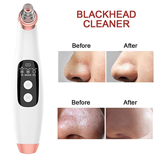 Succionador de Puntos Negros con Cámara, WIFI Removedor de Espinilla Visible Eléctrico para Facial Acne Pimple Grease, USB Recargable, 6 Puntas reemplazable - Compatible con Android IOS Windows Mac