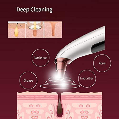 Succionador de Puntos Negros con Cámara, WIFI Removedor de Espinilla Visible Eléctrico para Facial Acne Pimple Grease, USB Recargable, 6 Puntas reemplazable - Compatible con Android IOS Windows Mac