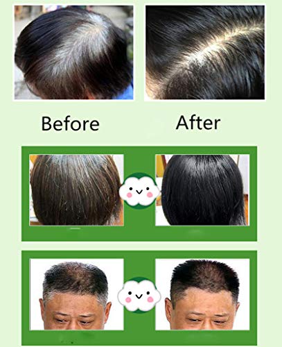 Unim Champú De Tinte De Cabello Negro Instantáneo, Negro, Paquete De 10 - 280 G