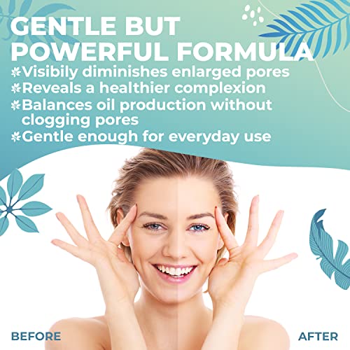 Vera Tonico Facial Piel Grasa y Mixta con Acido Salicilico BHA, Acido Hialuronico y Aloe Vera - Tratamiento Acne Facial con Acido Salicilico Facial - Tonico Piel Grasa con Ácido Salicílico Acné, 250ml