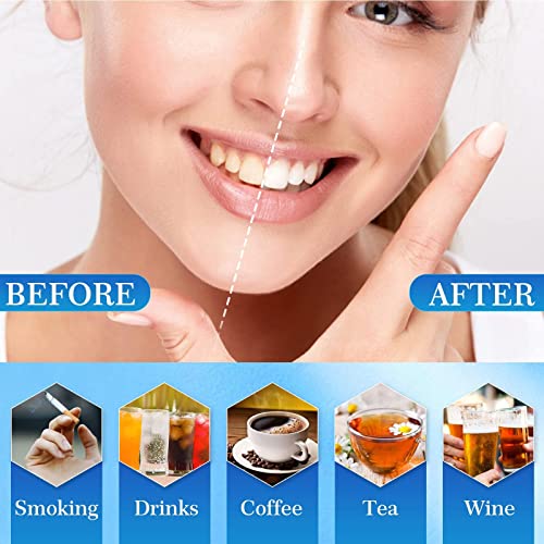 Blanqueador Dental Profesional,Kit de Blanqueamiento Dientes-12*Gel Blanqueamiento,3*Gel Calmante,Hilo Dental,Kit de Blanqueamiento Dental Reutilizable,Seguro y Suave,Cuidado Dental Completo Hogar