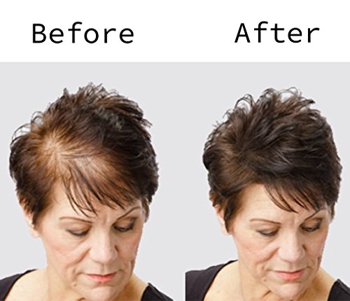 BLISSANY Fibras capilares - Engrosamiento del cabello - Cabello desparramado - Polvo capilar - Fibras capilares para hombres y mujeres - Pelo grueso inmediatamente atrás, 28g (marrón oscuro)