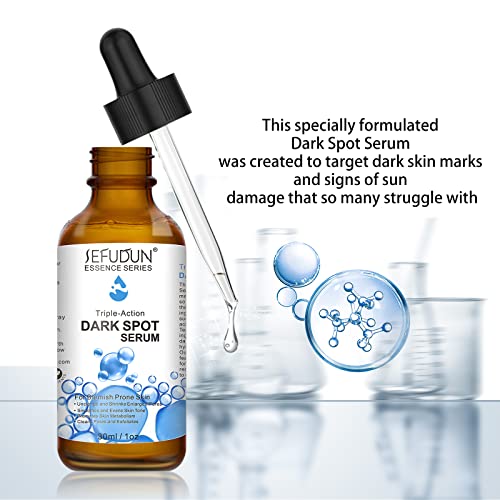 Cosmpro Serum Antimanchas para Peeling Facial, Serum corrector de manchas oscuras para rostro y cuerpo, con 2% alfa arbutina, ácido kójico, extracto de raíz