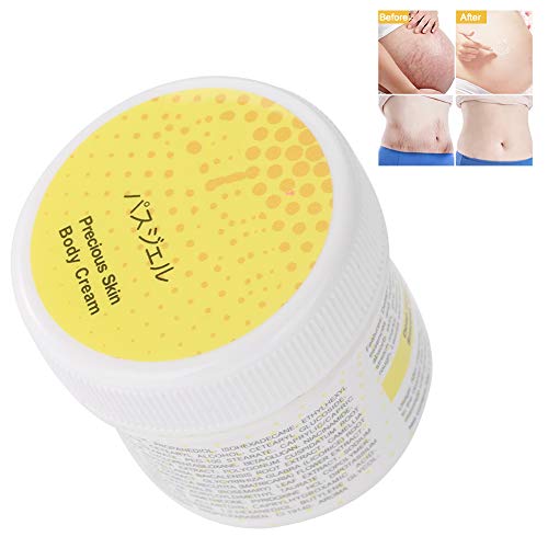 Crema para estrías, Gel reparador de la piel, Eliminación de cicatrices contra el acné para la maternidad postparto.