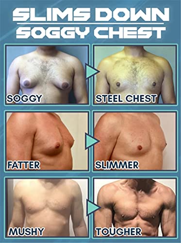 Gynecomastia Cellulite Melting Spray, Spray Anticelulítico, Spray Adelgazante Seguro Sin Celulitis, Spray Adelgazante Corporal Para Bajar De Peso, Spray Lipo Líquido (30ml)