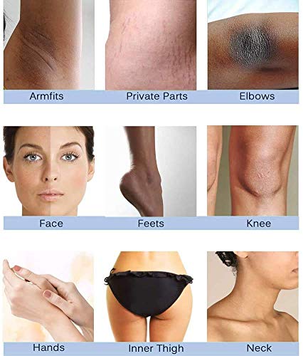 Skin Whitening Cream,Crema Aclaradora,Blanqueador Crema,Crema blanqueadora corporal,aclara el tono de la piel,blanquea e hidrata,Eficaz para Axilas,Rodillas,Codos, Zonas Sensibles y Privadas