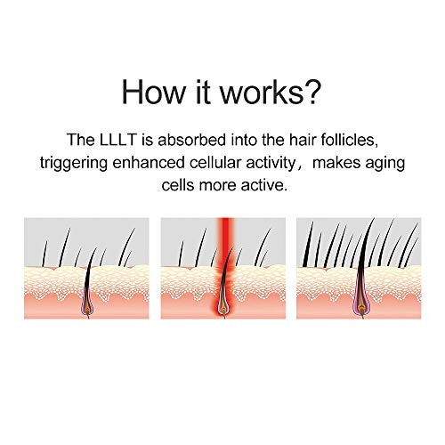 Tratamientos crecepelos, Crecimiento del Cabello - Aprobado por la FDA, restaura el volumen y la densidad del grosor del cabello - Apropiado para Hombres y Mujeres