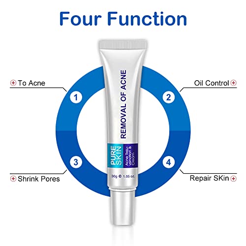 Crema Antiacné,Crema Para el Acné,Tratamiento Del Acné,Reducir Las Marcas de Acné,Mejorar La Piel Del Acné Hacer la Piel Suave y Lisa 30g