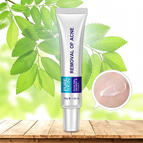 Crema Antiacné,Crema Para el Acné,Tratamiento Del Acné,Reducir Las Marcas de Acné,Mejorar La Piel Del Acné Hacer la Piel Suave y Lisa 30g