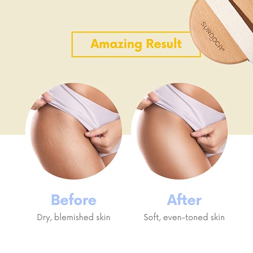 SURDOCA Cepillo Exfoliante Corporal para Cepillado en Seco y Ducha, Depurador de Espalda de Baño para Celulitis y Linfáticos, Exfoliante Suave y Masaje con Multipoint-Massage-Tech (Cerdas de nailon)