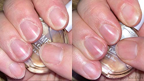 AIMEILI Acondicionador de Cutículas y Uñas Nail Solaroil Cuticle Oil Nutritivo Para Uñas Tratamiento de Cutícula Aceite Revitalizador Esmalte de Uñas Nutre el Protector de la Piel Cuidado de Uñas 15ML