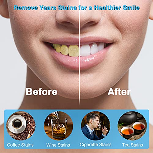 Blanqueador Dental Profesional Kit de Blanqueamiento Dental Teeth Whitening Kit,Para Manchas de Humo, Dientes Negros, Dientes Amarillos-10x3ML Gel, 1x Luz LED, 2x Bandeja Dental