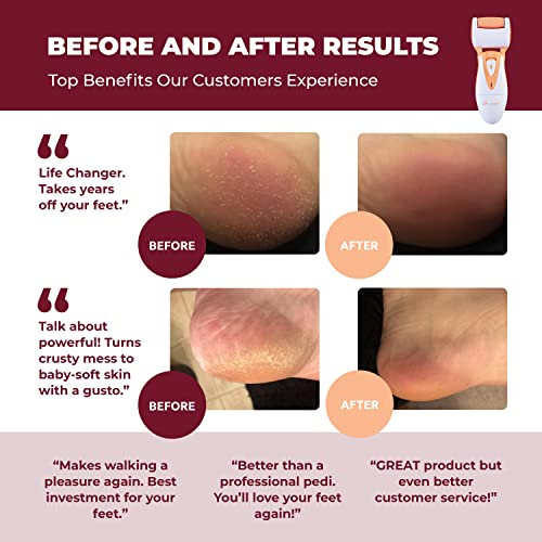 Lima-Electrónica para Callosidades Own Harmony - Poderoso Removedor de Callos de EE.UU.- Herramientas de Pedicura Recargables con 3 Diamond Rodillos - Spa Profesional el Suaves Cuidado de los Pies