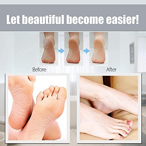 Recambios de limas para pies, recambios de papeles de lija, repuestos de limas abrasivas para pedicura, lima para pies de doble cara, color negro, paquete de 100 unidades