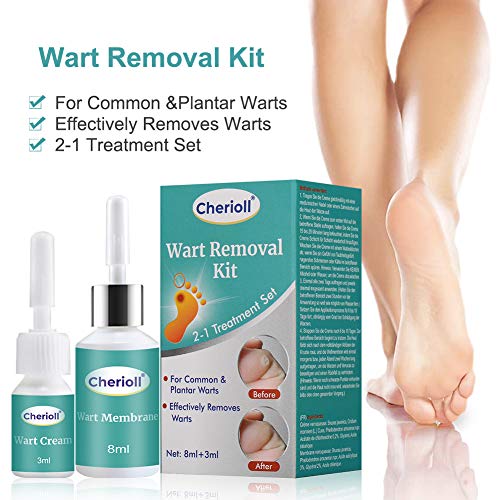 Removedor de verrugas, Eliminar Verrugas, Eliminar Durezas Y Callos, Tratamiento de verrugas Líquido eliminador de verrugas, Kit Para Eliminar Verrugas