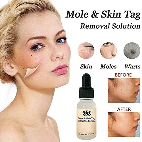 fghj 3pcs Organic Skin Spot Purifying Serum, Skin Tags Solutions Serum, Dark Spot Corrector Mole Remover, All Natural Purifying Serum Fix Black Spot,Safe,Effective