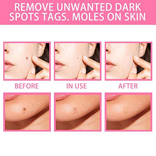 IPQYIHF Organic Skin Spot Solution, Organic Skin Spot Purifying Serum, Skin Tag Removal Cream, Face Serum for Women, All Natural Mole Removal, Fast & Effective (3 PCS)