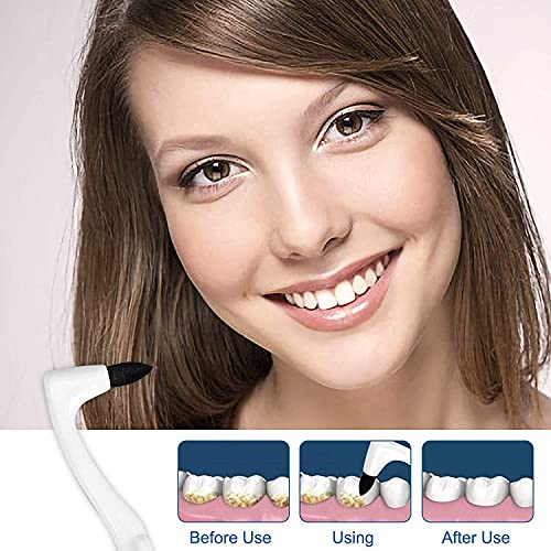 iZhuoKe Eliminación de sarro Dientes,Paquete de 2 Eliminación de sarro Quitamanchas de dientes profesional para té, café, tabaco, manchas de bebida de cola, antideslizante (Blanco y Azul)