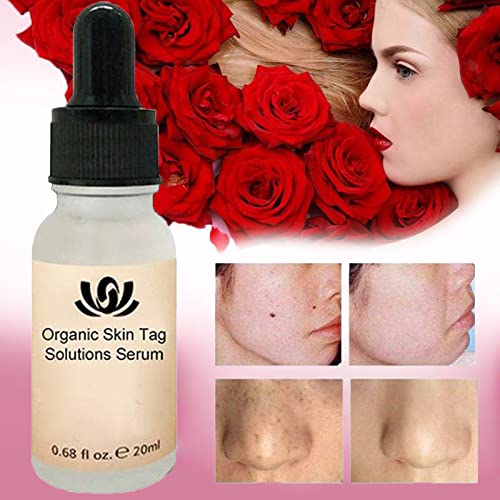 LXLX Organic Skin Tag Solutions Serum, Mole Corrector Skin Tag Remover, Organic Tags Solutions Serum, Anti Aging Serum & Dark Spot Corrector for Face - Natural Plant Formula (2PCS)