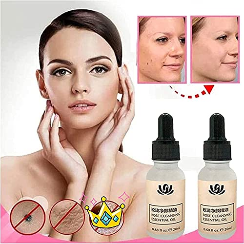 MTDBAOD Organic Tags Solutions Serum,Pure Natural Mole and Skin Tag Remover,Dark Spot Corrector Brightening Serum,Repair Cream Oil,for Spot Remover,Wart and Tag Removal (2PCS)