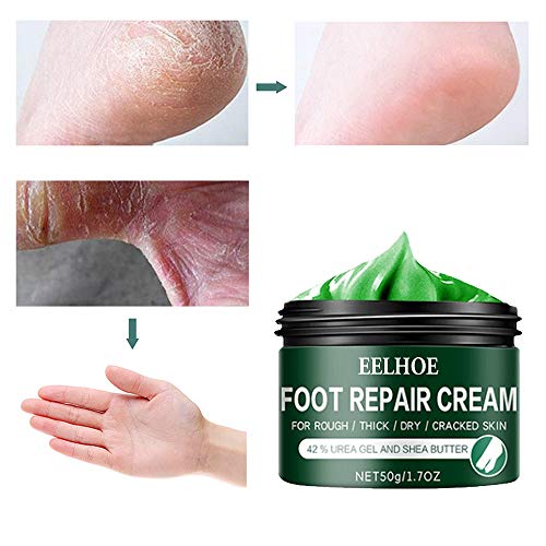Soolike Crema para Pies ORGÁNICA 50G – Crema Reparadora para Pies Secos, Talones Agrietados – Masaje y Pedicura contra Grietas y Callos con Aloe Vera Puro,Crema reparador de pies contra la picazón