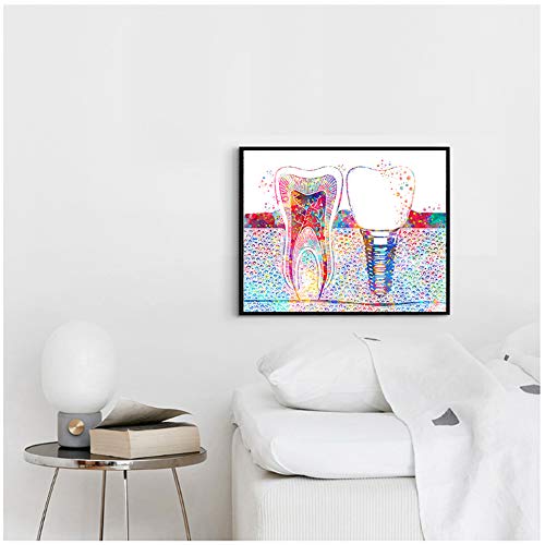 ZMFBHFBH Cuadro en Lienzo Arte Dental Imagen Implante Dental Dentista Arte de la Pared Pintura Medicina Higienista Cartel Clínica Dental Decoración 20x30cm (7.8"x11.8) Sin Marco