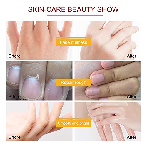 Guantes Hidratantes Para Manos, 5 Pares de Máscara de Mano Hidratante Exfoliante de Leche de Miel con Suero y Vitaminas, Colágeno, Reparación de Piel áspera, Blanqueamiento y Antienvejecimiento