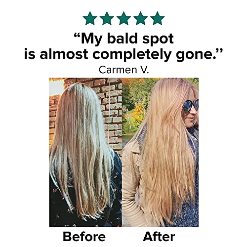 Moerie Mineral Shampoo & Hair Conditioner Set – For Longer, Thicker, Fuller Hair - Vegan Hair Products – Paraben Free Hair Products – All Hair Types – Reverse Hair Loss - 2 x 250ml