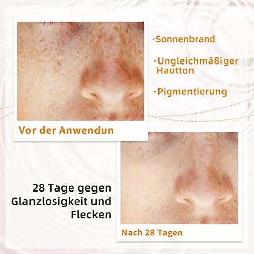 NAVI Ultra-Whitening/Serum Facial Alta Concentración Vitamina-C 30% / Suero Belleza Antimanchas & Hidratante, 15 ml