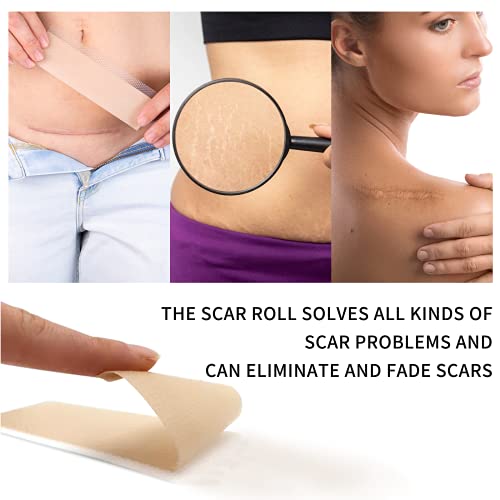 Tiritas Cicatrizantes, Láminas de Silicona Parches Cicatrizantes, Profesionales Reductor de Cicatrices Producidas por Cicatriz Acne Queloides Cirugía Quemaduras Cirugía Heridas Traumáticas,4X300 CM