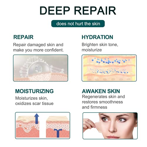 Tiritas Cicatrizantes, Láminas de Silicona Parches Cicatrizantes, Profesionales Reductor de Cicatrices Producidas por Cicatriz Acne Queloides Cirugía Quemaduras Cirugía Heridas Traumáticas,4X300 CM